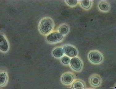 saccharomyces, gærceller